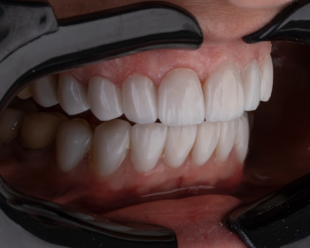 Teeth